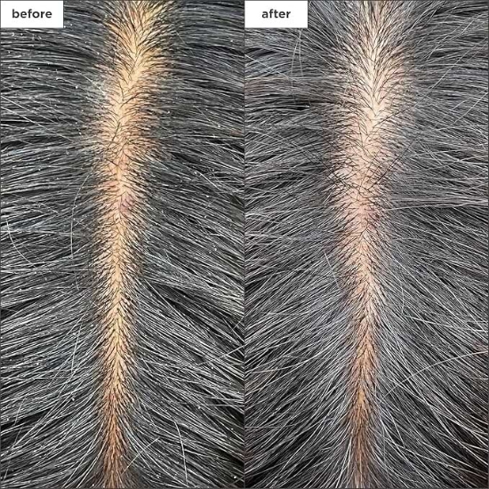 Picture of Briogeo Scalp Revival Charcoal + Tea Tree Cooling Hydration Scalp Mask 177ml