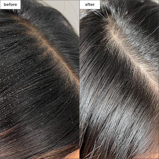 Picture of Briogeo Scalp Revival Charcoal + Tea Tree Buildup Detox Spray 120ml